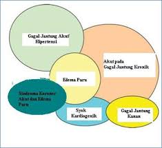 Check spelling or type a new query. Gagal Jantung Heart Failure Informasi Kedokteran Dan Kesehatan