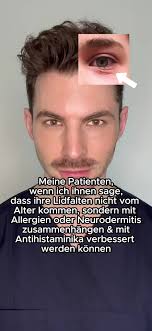 Behandlung von Dennie-Morgan-Falten bei Neurodermitis und Allergien