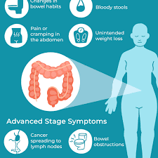 It is most commonly used to introduce a list, but it can also introduce words. Colon Cancer In Women Signs Symptoms And Complications