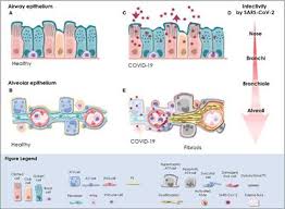 Our train (leave) at 4:47. Human Based Advanced In Vitro Approaches To Investigate Lung Fibrosis And Pulmonary Effects Of Covid 19 Medicine Frontiers
