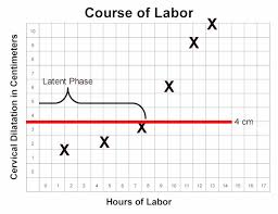 Image result for First Stage of Labor