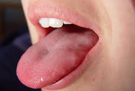 Tingling Tongue Causes And When To See A Doctor