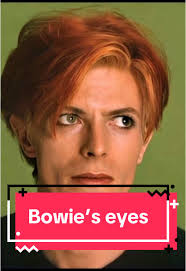 What Happened to David Bowie Eyes