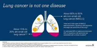 Image result for Lung Cancer