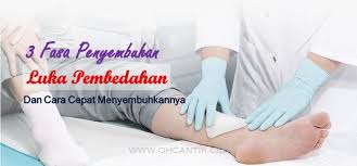 Di video berikut ini membahas bagaimna tahapan penyembuhan luka. Luka Jahitan Bersalin Lambat Kering Ohcantik Com