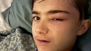 Fundraiser by Julie Gaffney : Support Max's Recovery from Brain Surgery