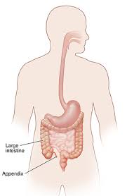 Image result for Appendicitis