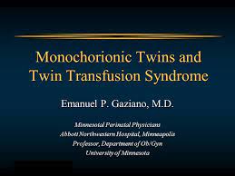 Monochorionic Twins And Twin Transfusion Syndrome Ppt Video Online Download