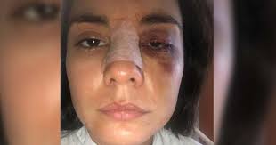 Agarré mi celular y me hice una selfie y un video pidiendo ayuda» Eileen  Moreno, actriz colombiana