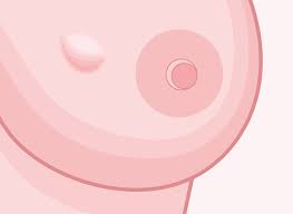 Spots that bleed and won't go away are also signs of skin cancer. The Breast Most Cancers Warning Signs And Symptoms You Shouldn T Forget About Health Cise