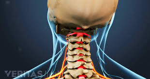 Pin On Neck Pain