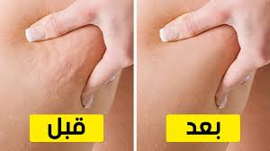 6 تمارين للتخلص من السيلوليت في أسبوعين youtube