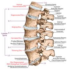 Maybe you would like to learn more about one of these? How Long For Herniated Disc Back Pain Bulging Disc Back Pain Degenerative Disc Disease Pain To Heal Without Surgery Manhattan Wellness Family Chiropractor Near Me Acupuncture Near Me Lower