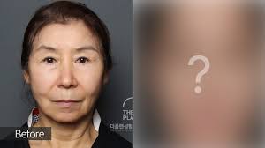 THE PLAN Plastic Surgery