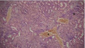 Image result for Alchornea occidentalis