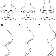 Feb 24, 2020 · i relate to three different starseed types. Three Classified Types Of Short Nose At Frontal View A C And Side Download Scientific Diagram
