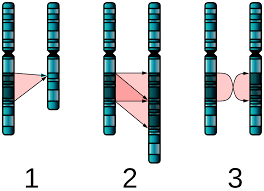 chromosome abnormality wikipedia