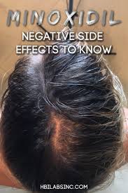 Although the exact mechanism of this drug in hair growth isn't fully understood, it's widely accepted that by widening the blood vessels and opening potassium channels. 11 Negative Minoxidil Side Effects To Know Hair Loss Natural Remedy Hair Loss Cure Minoxidil