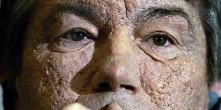 Mehr zu symptomen, diagnose, behandlung, komplikationen, ursachen und prognose lesen. Viktor Juschtschenko Kolner Galeristin Brigitte Schenk Trifft Beruhmten Ukrainischen Ex Prasidenten Express De