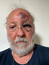 Dangerous stairs with 5 step drop