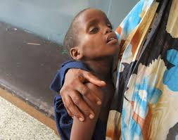 Committee on the rights of persons with disabilities. Sackeweise Lebensmittelhilfen In Somalia Gestohlen Welt