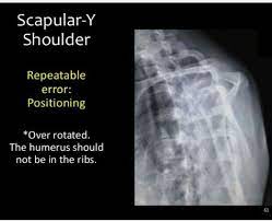 Y View Over Rotated Radiology Technician Radiology Technologist Radiology Tech