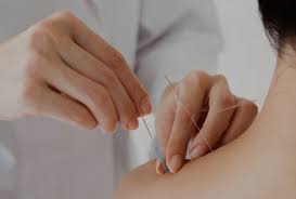 Acumedic invented the disposable acupuncture needle in the 1980's and for over 30 years we have been for more information about all acumedic acupuncture needles please read our guide. Acupunctureworld Home Page The Whole World Of Acupuncture