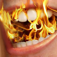 Burning Mouth Syndrome British Association Of Oral And Maxillofacial Surgeons