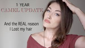 Unless specified, please assume all the groups are public & unaffiliated i.e. 1 Year Camel Urine Update And The Real Reason My Hair Fell Out Story Time Youtube