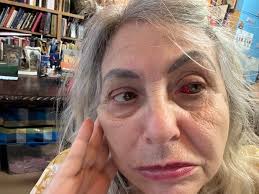 Honestly i love the dunk and egg comics but Bloodraven with an eye patch  looks horrible