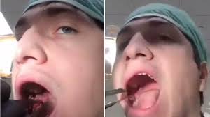 I woke up to a seriously painful amount of pressure. Watch As Dentist Extracts His Own Wisdom Tooth In Viral Video Allure
