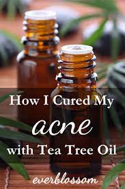 How To Use Tea Tree Oil For Acne Tea Tree Oil For Acne Natural Acne Natural Acne Treatment