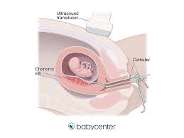 When in doubt, always check with the organization or individual who. Chorionic Villus Sampling Cvs When Why And How It S Done Babycenter