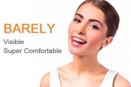 Ceramic Braces product image