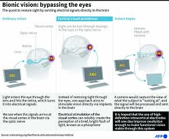 Vision Restoring Brain Implants Spell Breakthrough