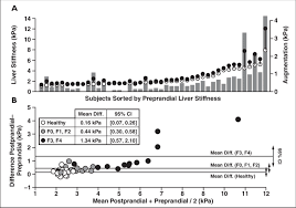Pre And Postprandial Liver Stiffness Measurements And