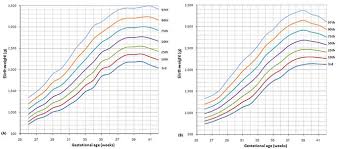 The Percentile Curves Of Birth Weight By Gestational Age For