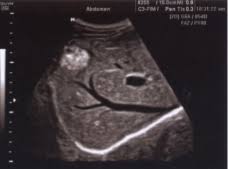 ultrassonografia abdominal bh dr matsushita