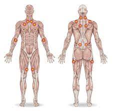 (fibromiyalji sendromu, fibromiyalji noktaları) fibromiyalji belirtileri nelerdir? Fibromiyalji Kuantum Fizik Tedavi Rehabilitasyon Merkezi