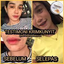 Krim armpit new white deodorant. Ramai Yg Tanya Kesan Krim Kunyit Viral By Fs Beauty Facebook