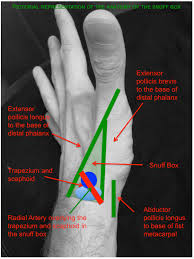 It is a minor fracture which heals with minimal intervention. Ortho Induction Rcemlearning Netherlands