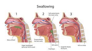 Food that is stuck in the throat can either be choked up back into your mouth or with great difficulty, swallowed. How To Deal With Dysphagia When You Have Ms Everyday Health