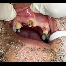 Clinica Dental Dr. Angel M. Torres Torres