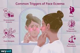 The most common areas for eczema on the face are the eyelids and the lips, given how thin and sensitive the skin is in these areas, explains shilpi khetarpal, md, a dermatologist at the cleveland clinic and clinical assistant professor of medicine at. Eczema On The Face Symptoms Causes Diagnosis Treatment