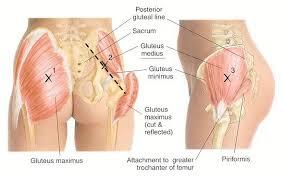 Place your arms by your sides and bring your heels up toward your butt. Gluteal Tendinopathy In Melbourne