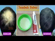 Penumbuh Rambut Super Cepat Tanpa Resiko Youtube Perawatan Rambut Rontok Pertumbuhan Rambut Rambut Alami