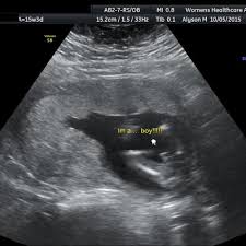 Mit dem geburtsterminsrechner können sie den. 16 Ssw Schwangerschaftswoche Alle Infos Grosse Entwicklung