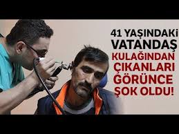 Kulagindan Sinek Larvasi Kurtcuk Cikti Youtube