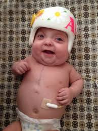 Dear Abby: Feeding Tube Awareness Week