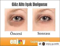 Repost Enjoy Guzellik With Repostapp Goz Alti Isik Dolgusu Goz Altindaki Cokukluk Ve Mor Halka Gorunumunu Duzeltir Dokt Makeup Incoming Call Screenshot